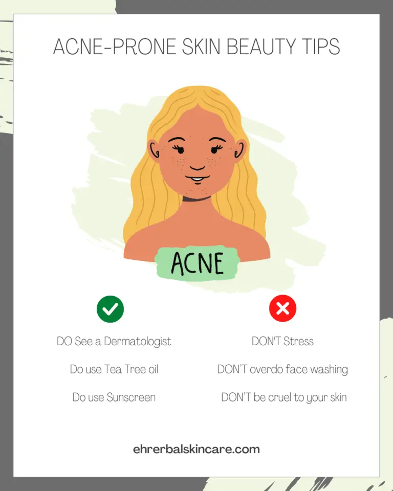 natural remedies for acne